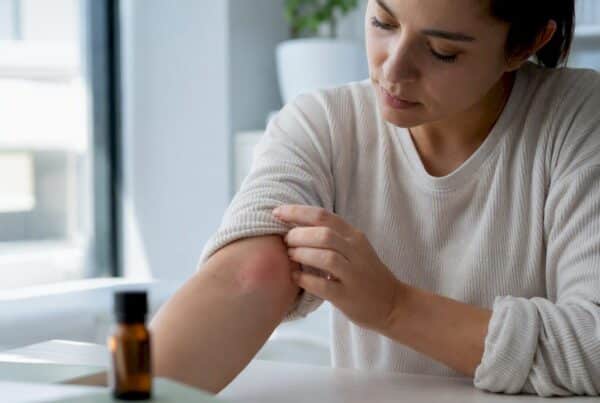Forearm examination if allergy is suspected