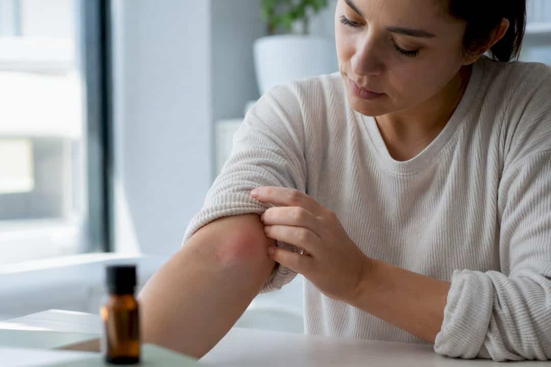 Examen de l’avant-bras en cas de suspicion d’allergie