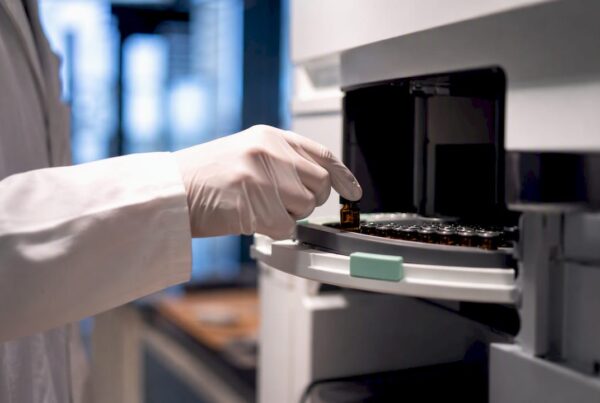 Analyse chromatographique d’un échantillon de CBG
